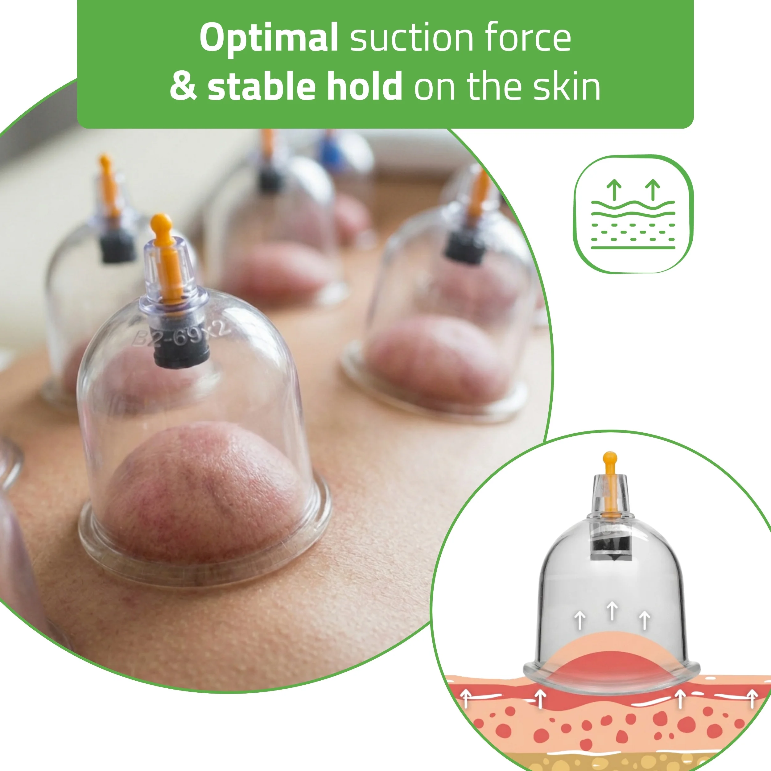 Vakumske čašice za cupping masažu s pumpicom – 14 kom. – prikaz 7